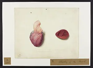 Hopital: Atrophy of the Heart