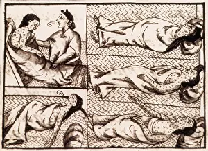 Smallpox: Aztecs Dying of Smallpox