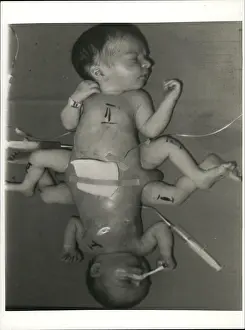 Waldemar: Babies - Children - Multiple Births