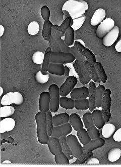 Bacillus: Bacillus sp. bacteria