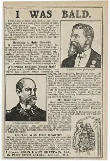 Baldness: BALDNESS CURED 1919