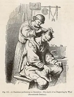 BARBER-SURGEON OPERATION