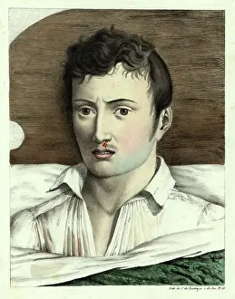 The Kings College Archives And Special Collections: In bed with yellow fever