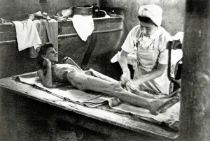 Dysentery: Bergen-Belsen Concentration Camp - Treatment of a survivor