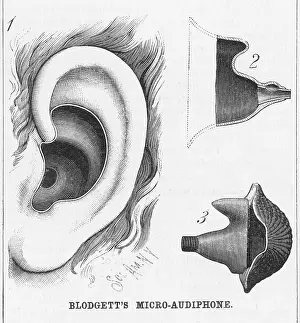 Hearing: Blodgett's Hearing Aid