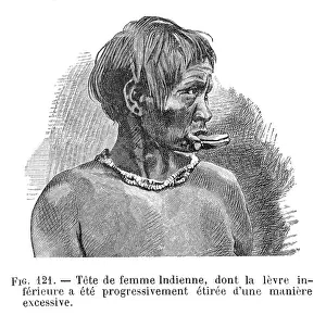 Deformation: BODY DEFORMATION/LIPS