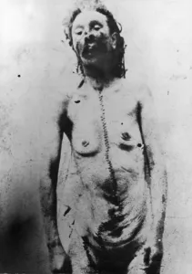 Ripper: BODY OF VICTIM, EDDOWES
