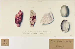Plantes: Bone and Spleen Tubercles (Monkey)