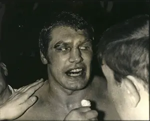 Scarred: Boxing