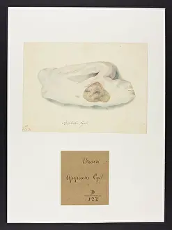 Septr: Brain: Apoplectic Cyst