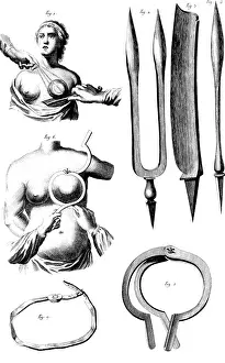 Navel: Breast Surgery Instruments, 1772