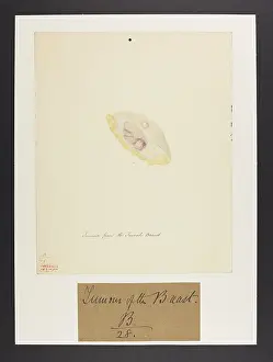 Ucl Library Services Digital Collections: Breast: Tumour
