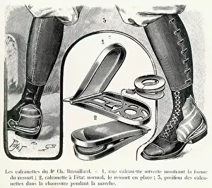 Innovative: Breuillard's device to assist walking