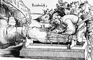 1528: Broken leg, 1528