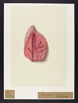 Bronchi: Bronchi: Entozoa