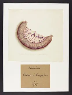 Portion: Cadaveric Congesting of a Portion of Small Intestine