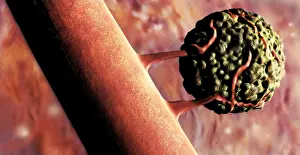 Pathology: Cancer Cell, Illustration
