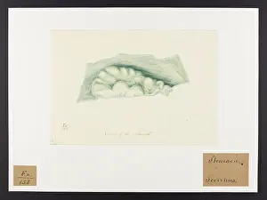Stomach: Cancer of the Stomach