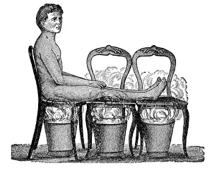 Sweating: Cane chair steam bath, 1902