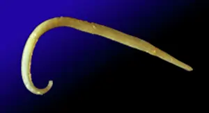 Intestine: Capillaria philippinensis, parasitic worm