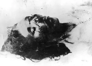 Stitches: CATHERINE EDDOWES FACE