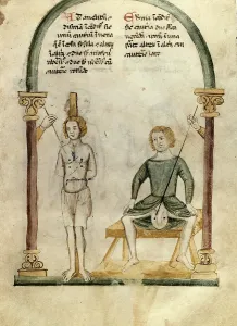 Genital: Cauterization and preparation. Miniature. Ms.Rawlinson