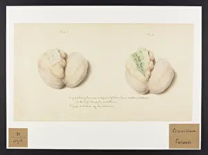 Cerebellum: Cerebellum: Tubercle