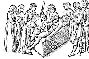 Regia: Cesarean Section, 16th Century
