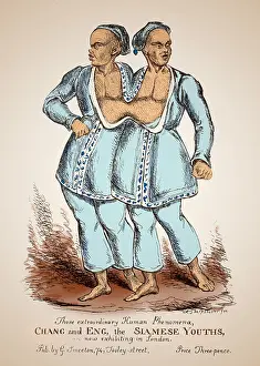 Disability: Chang and Eng Bunker, Siamese Twins
