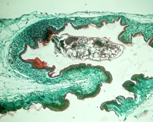 Lacertilia: Chiggers, larvae of trombiculid mites