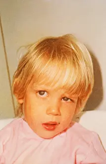 Virus: Child with Bell's Palsy