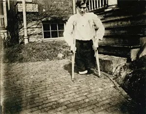 Dismembered: Child Labor, Frank, whose legs were cut ?