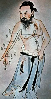 Acupuncture: Chinese Acupuncture Points