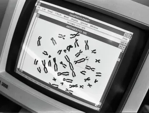 Everyone: Chromosomes affected by radiation after Chernobyl