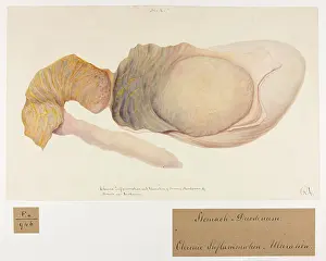 1837: Chronic Inflammation and Ulceration of Stomach and Duodenum