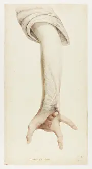 Hopital: Cicatrix of a Burn