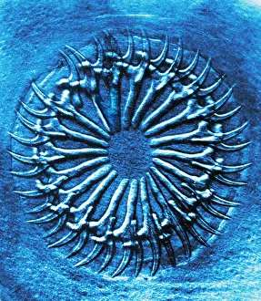 Circlet: Circlet of Hooks on Scolex, Early Photomicrograph