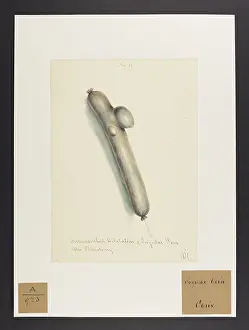 Ucl Library Services Digital Collections: Circumscribed Dilatation of Jugular Vein after Phlebotomy
