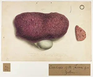Liver: Cirrhosis of Liver of a Zebu