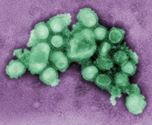 Microbes: This colorized negative stained transmission ?