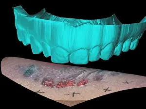 Forensic: Computer Reconstruction of Bite Mark
