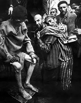 Malnutrition: concentration camp - holocaust - WW2 - prisoners