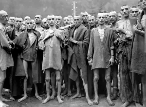 Malnutrition: concentration camp - holocaust - WW2 - prisoners