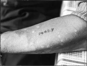 Scarred: CONCENTRATION CAMP number