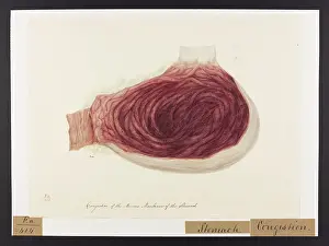 Stomach: Congestion of the Mucous Membrane of the Stomach