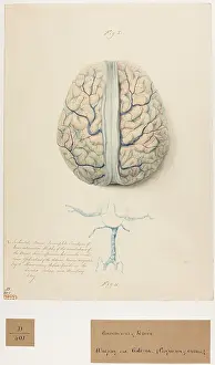 Femmes: Convolutions of brain: atrophy and oedema