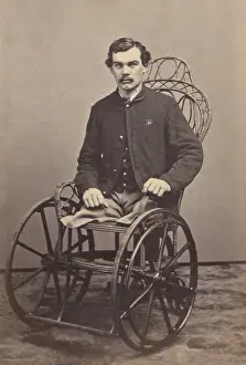 Amputations: Corporal Michael Dunn of Co. H, 46th Pennsylvania