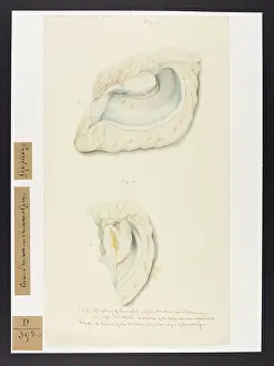 Corpus: Corpus Striatum and Thalamus Opticus: Apoplexy