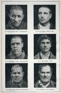Revealed: CRIMINAL TYPES/LOMBROSO