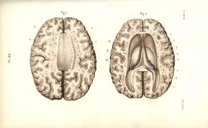 Leveille: Cross sections through the brain